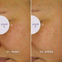 Ren Sérum Bio Jeunesse – Retinoid 30ml -MenCorner Boutique bio retinoid serum jeunesse 3292886 4 1140x1140