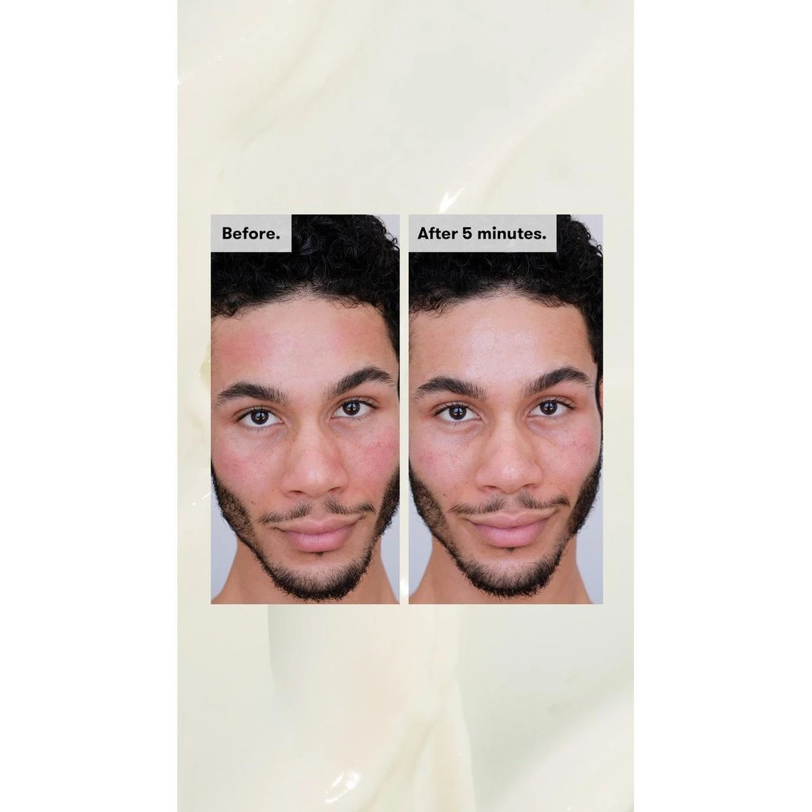 Ren Crème De Jour Protectrice – Evercalm 50ml 7 Ren Crème De Jour Protectrice – Evercalm 50ml – Image 5