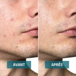 Nettoyant Doux Visage Homme 200 Ml -MenCorner Boutique nettoyant doux visage homme 3516618 3 1140x1140