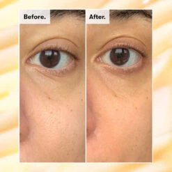 Ren Soin Illuminateur Anti Cernes Pour Le Contour Des Yeux 15ml -MenCorner Boutique soin clat contour des yeux anti cernes 3205604 5 1140x1140